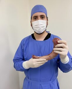 Manga gástrica en Ciudad Obregón | Cirugía bariátrica